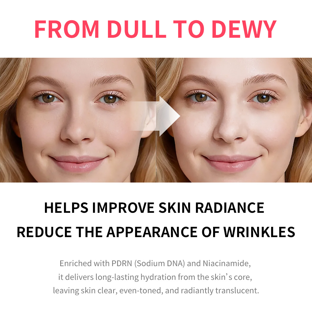 PDRN Pink Niacinamide Milky To - огляд і ціна Echinacea